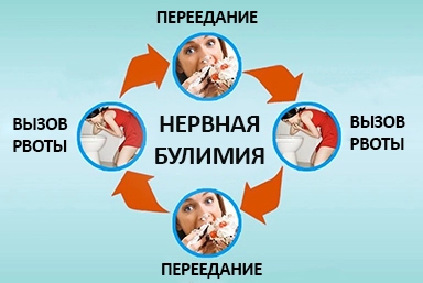 Лечение булимии в Истре